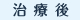 治療後
